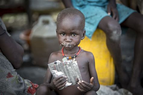 Ethiopian Children Starving