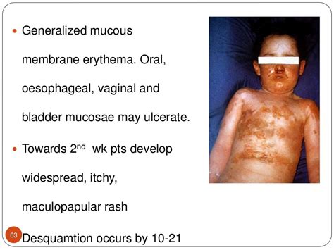 Staphylococcal And Streptococcal Skin Infections