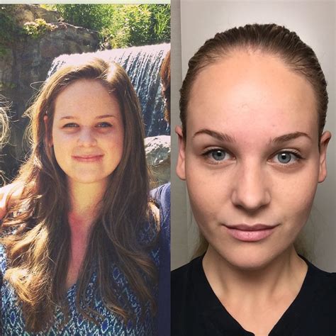 Weight Loss Face Before After Reddit Inspiring Weight Loss
