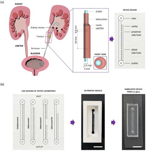 Urine Drains From The Ureters Into Bladder Through Best Drain Photos