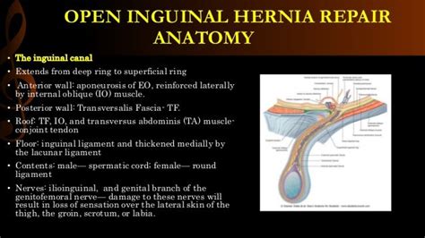 Open Inguinal Hernia Repair Operative Surgery