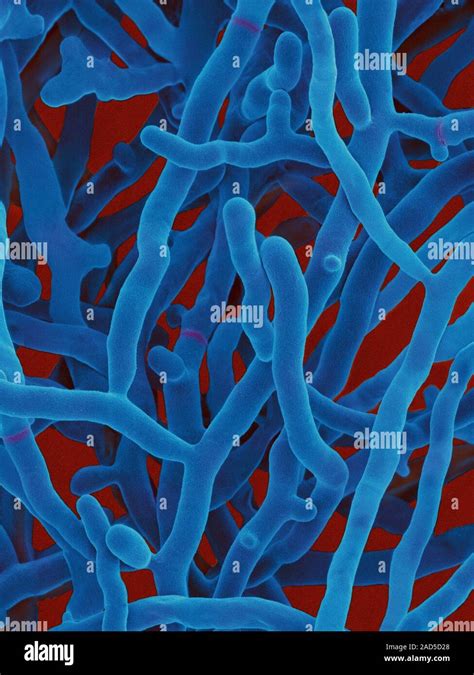 Coloured Scanning Electron Micrograph Sem Of Streptomyces