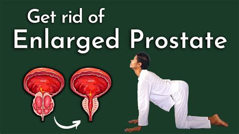 Yoga For Prostate Problems Best Exercises For Enlarged Prostate Prostate Health Remedies