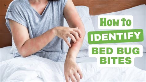 How To Identify Bed Bug Bites Your Ultimate Guide To Detecting And Dealing With Them Youtube