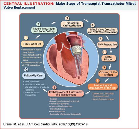 Transcatheter Mitral Valve Implantation Tmvi — Golden Shutter Films