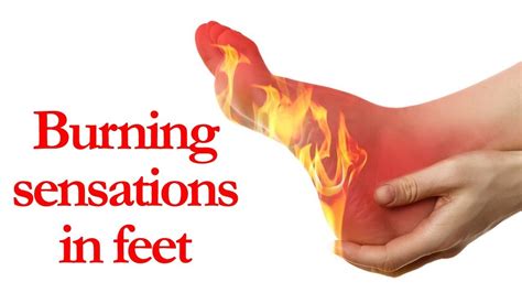 5 Home Remedies For Burning Sensations In Feet By Top 5 Youtube