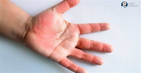 Carpal Tunnel Syndrome Symptoms Causes Risk Factors Diagnosis And Treatment