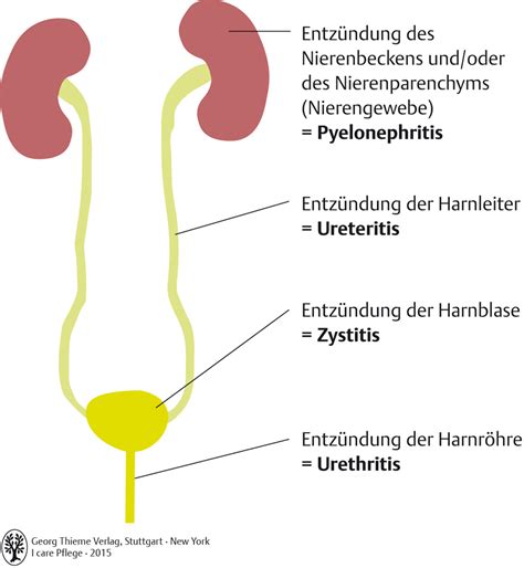 I care pflege bietet dir all das wissen, das du auf deinem weg zu einer professionellen und handlungskompetenten pflegekraft benötigst. 57. Niere und Harnwege - Pflegepädagogik - Georg Thieme Verlag