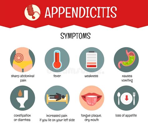 Appendicite Infografica Vettoriale Illustrazione Vettoriale