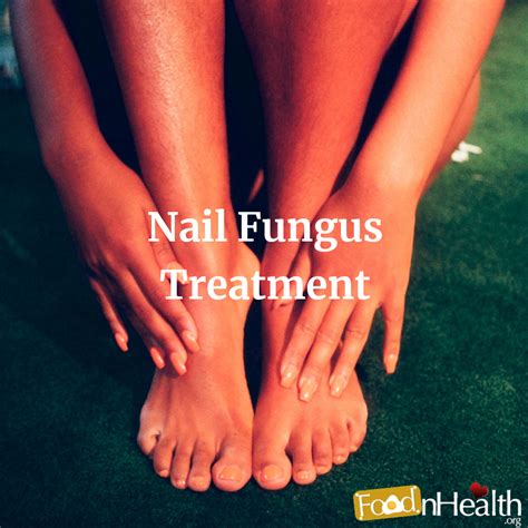 5 Great Remedies For Nail Fungus Treatment Food N Health
