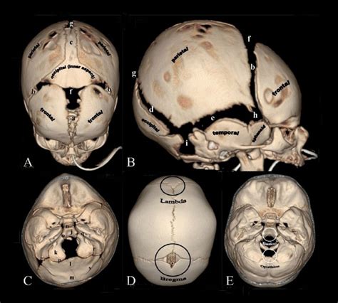 Musculoskeletal System Skull Development Embryology