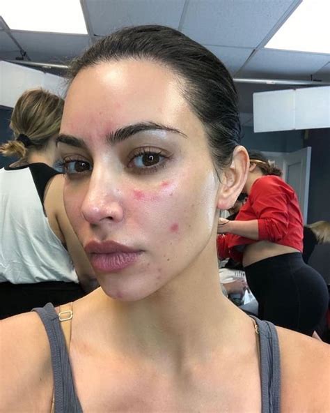 Top 90 Pictures Kim Kardashian With No Make Up Completed