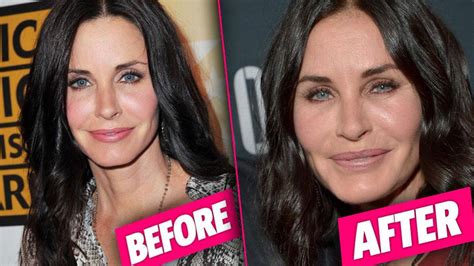 Frozen Face Courteney Cox Had Extreme Plastic Surgery On Lips Eyes