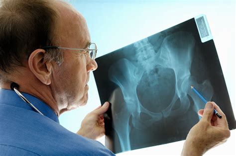 Orthopaedic Surgeon Consulting Pelvic Xrays For A Hip Replacement Stock