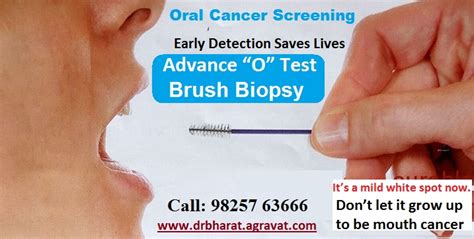 A canker sore looks like an ulcer, usually with a depression in the center. Mouth Cancer Diagnosis Symptoms Causes Treatment in ...
