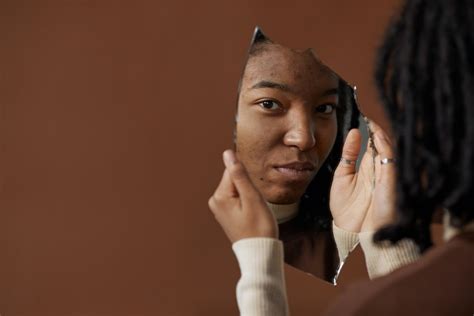 People With Darker Skin Likely To Suffer From Psychological Effects Of Acne Science Times
