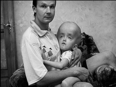 Tschernobyl neue hypothese zur atomkatastrophe. LeseBlick: Rezension "Tschernobyl - Eine Chronik der Zukunft"