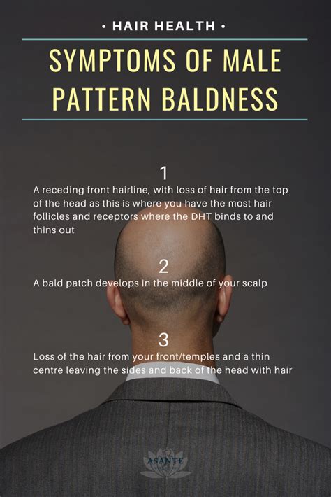 Symptoms Of Male Pattern Baldness In 2020 Male Pattern Baldness
