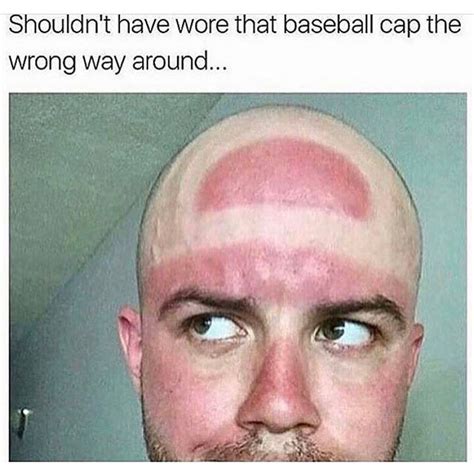 Also Dont Forget Sunscreen For Your Scalp Esp If Your Head Is Bald
