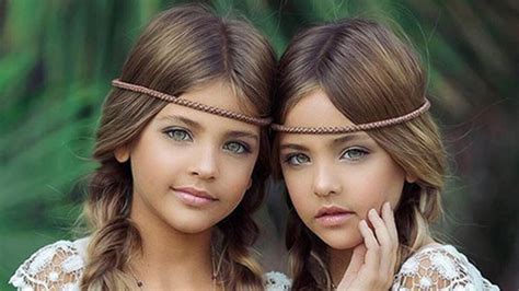 Das Sind Die Schönsten Zwillinge Der Welt Oe24at
