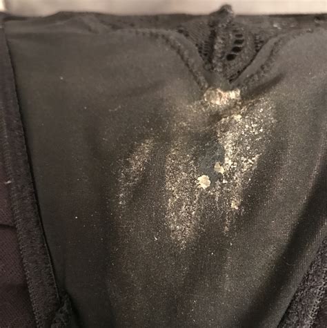 My Cm Is Clear Kind Of Milky Dries Like This And Have Had A Bit Of Discharge In My Panties