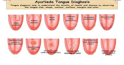 Ayurveda Tongue Diagnosis Jihva Parıksa