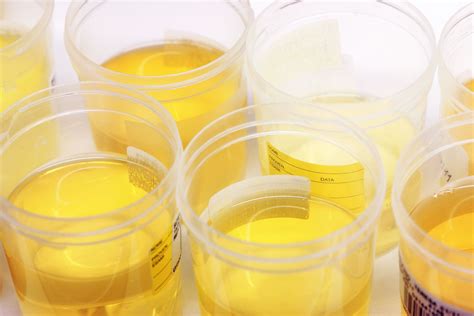 is it safe to drink urine