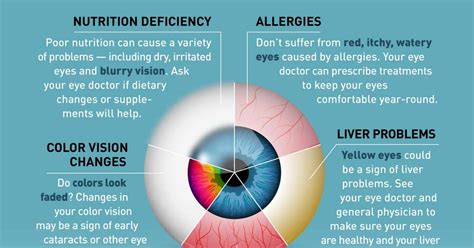 Infographic 10 Health Problems Your Eyes Could Be Showing Signs Of