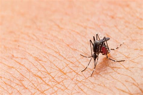 Do Mosquitoes Bite Symptoms From Mosquito Bites Leos Pest Control