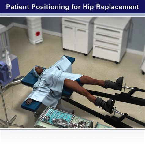 Patient Positioning For Direct Anterior Total Hip Arthroplasty