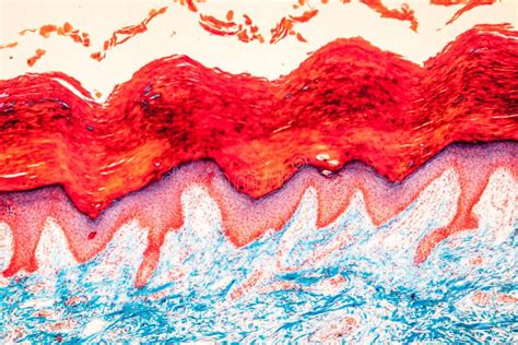 Scar Skin Tissue Stock Image Image Of Macro Histology 196730843
