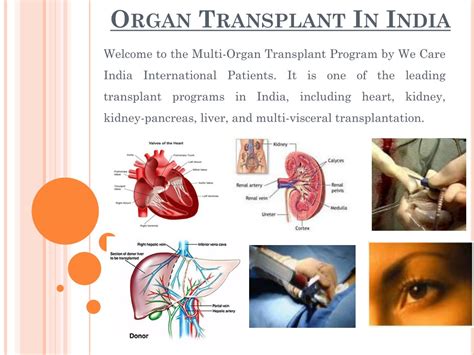 Ppt Organ Transplant Surgery India Powerpoint Presentation Free