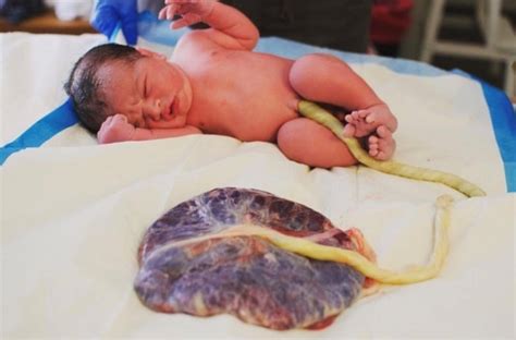 Learn the dos and don'ts of cleaning and maintenance for newborns, plus which signs to watch for. When a baby is born and the umbilical cord is cut, can a ...