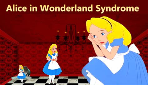 Alice In Wonderland Syndrome Dr Savitra