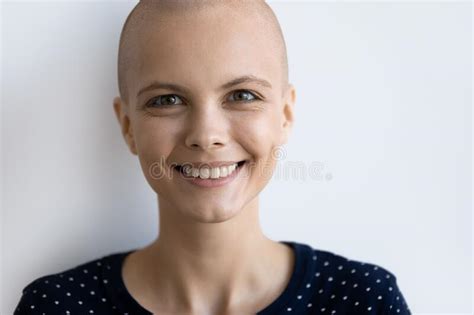 Portrait Of Happy Young Woman Without Hair Recovering From Cancer Stock Image Image Of