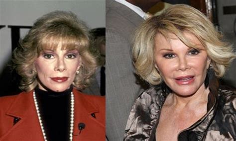 Top 5 Celebrity Plastic Surgery Disasters