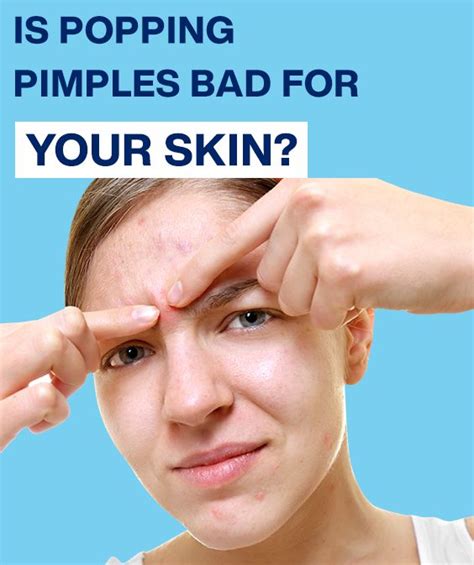 Why Is Popping Pimples Bad For Your Skin Pimples How To Get Rid Of
