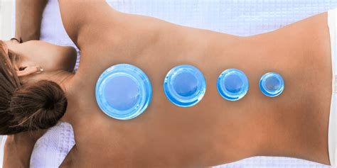 Cupping Therapy 101 Pro Tips Techniques And Benefits Lure Essentials