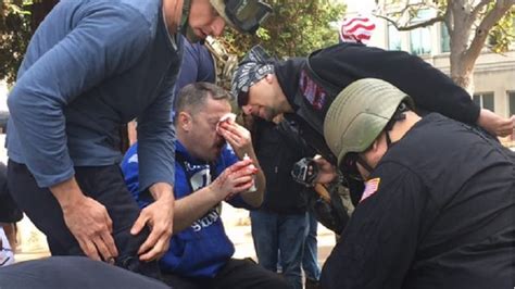 Photosvideo Violence Erupts At Berkeley Protests