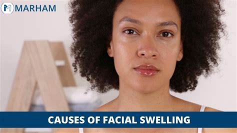 Causes Of Facial Swelling Marham