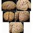 Left Occipital Lobe Convexity  Neuroanatomy The Neurosurgical Atlas