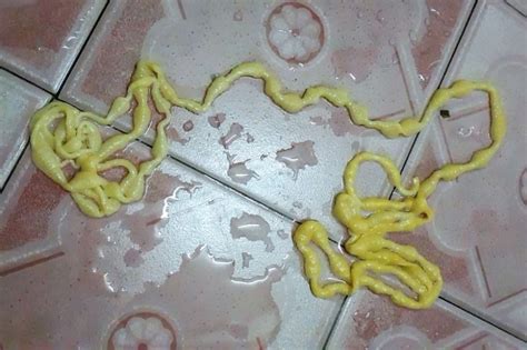 Bercakap dengan doktor kami tentang cara mengatasi sakit perut dengan melawati www.doctoroncall.com.my. Pemuda keluarkan cacing pita 5 meter dari punggung selepas ...