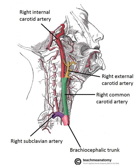 A piece of a plaque may break off and flow to smaller arteries in your brain. Major Arteries of the Head and Neck - Carotid - TeachMeAnatomy