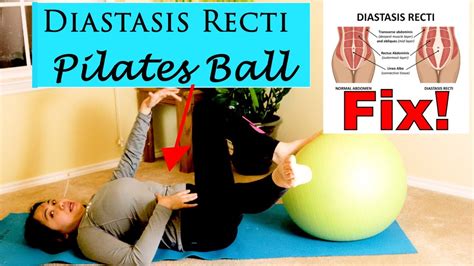 Diastasis Recti Core And Abdominal Strengthening Gentle Pilates Program
