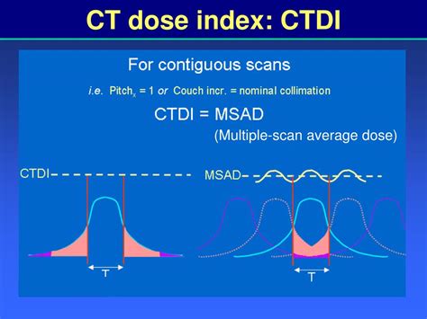 Ppt Radiation Dose Optimization Techniques In Mdct Era From Basics To Practice Powerpoint