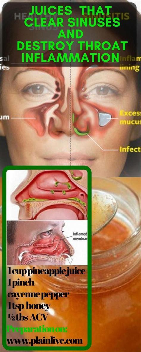 Home Remedies For Sore Throat Eye Skin And Also Sinus Infections