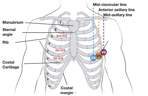 Holter Monitor 5 Lead Placement Diagram Wiring Diagram Source