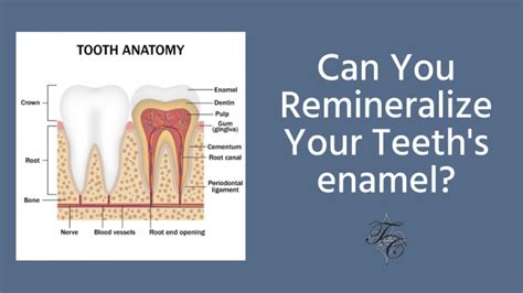 Can You Remineralize Teeths Enamel Tim Chauvin Dental Lafayette La