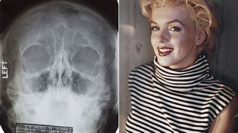 Notes Suggesting Marilyn Monroe Plastic Surgery For Sale Abc News