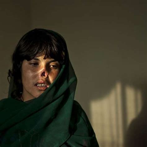 Bibi Aisha The Girl Whose Nose The Taliban Removed